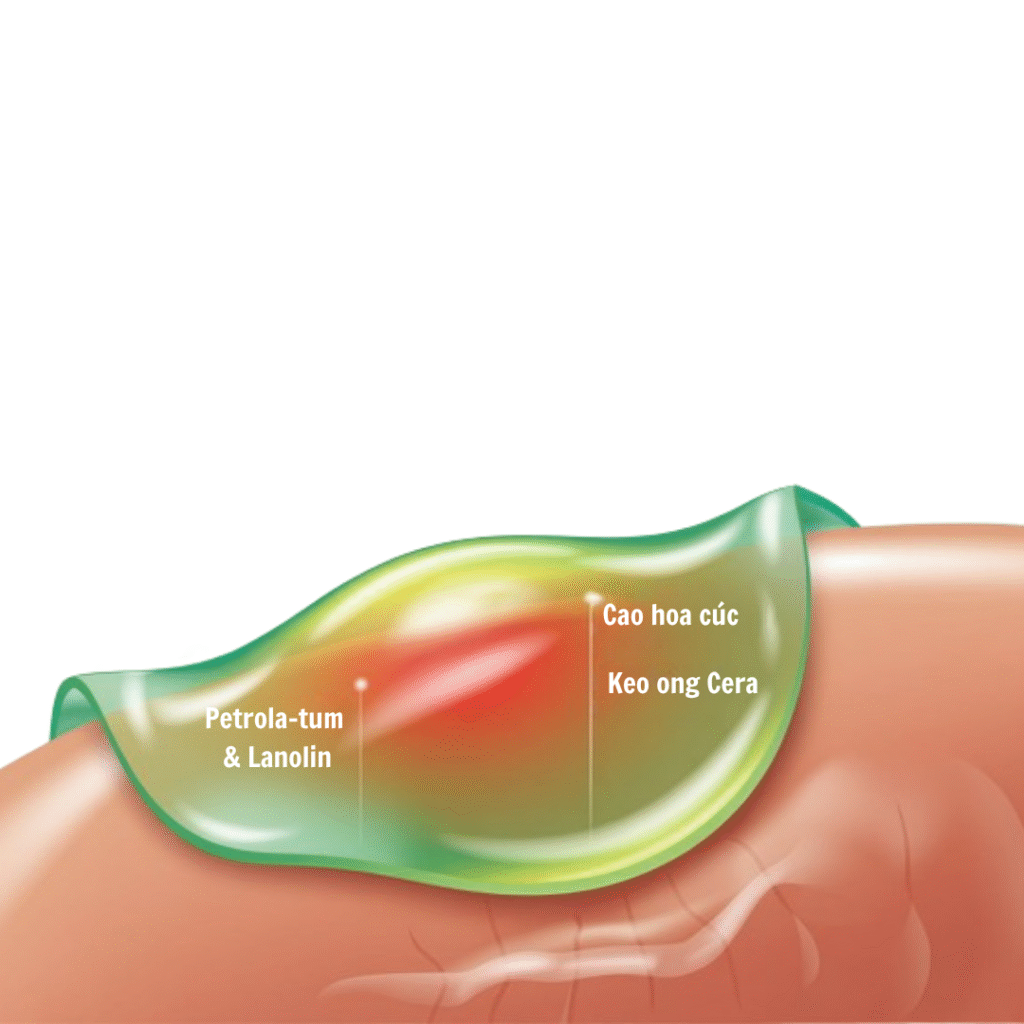 Giai-phap toi-uu-mang-bao-ve-tu-nhien-cho-nguoi-benh-tri